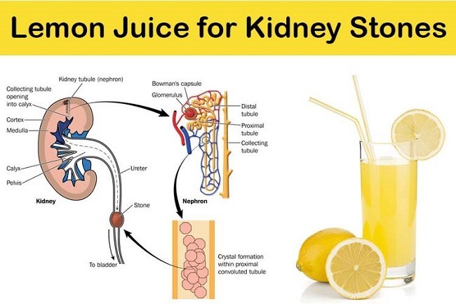 The super drink recipe for kidney health